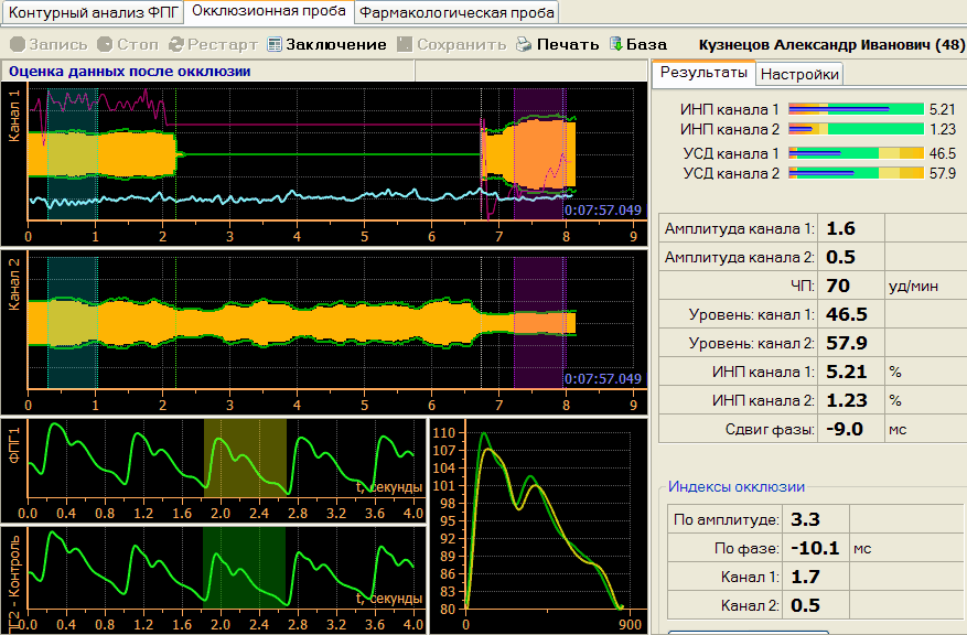 Профессиональный диагностический прибор AngioCode-322 для анализа состояния сердечно-сосудистой системы