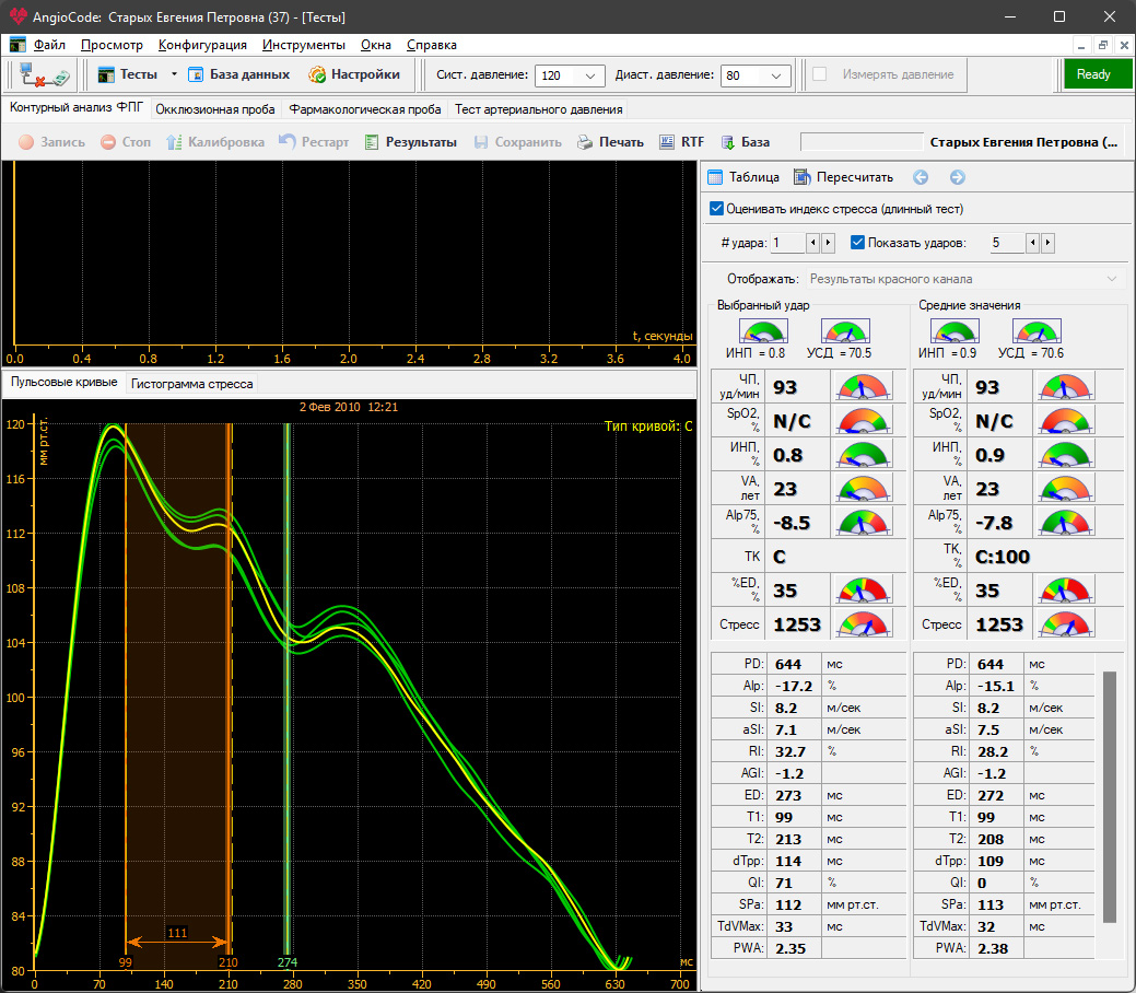 Профессиональный диагностический прибор AngioCode-322 для анализа состояния сердечно-сосудистой системы
